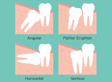 Best Oral Surgeon in Hollywood FL